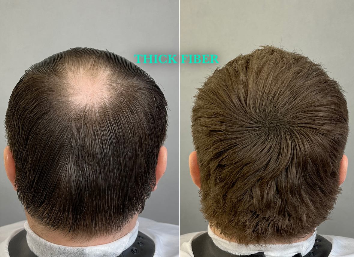 THICK FIBER Hair Building Fibers 25g – Pack of 4 – THICK FIBER