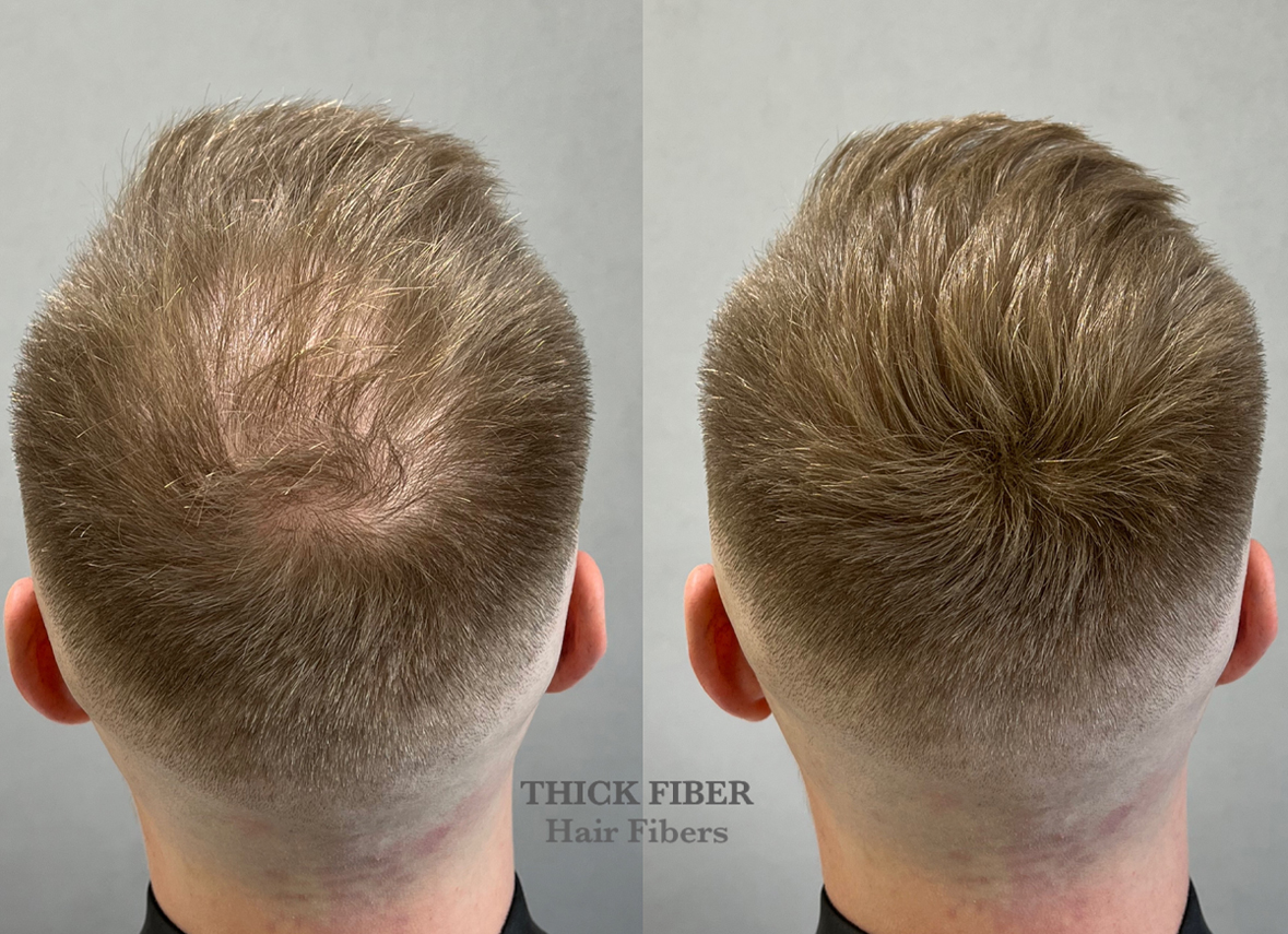 THICK FIBER Hair Building Fibers 25g – Value Pack – THICK FIBER
